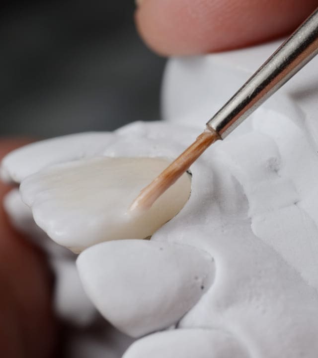 Ceramic powder baking procedure of fabricating bonding for teeth